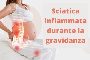 Sciatica infiammata durante la gravidanza